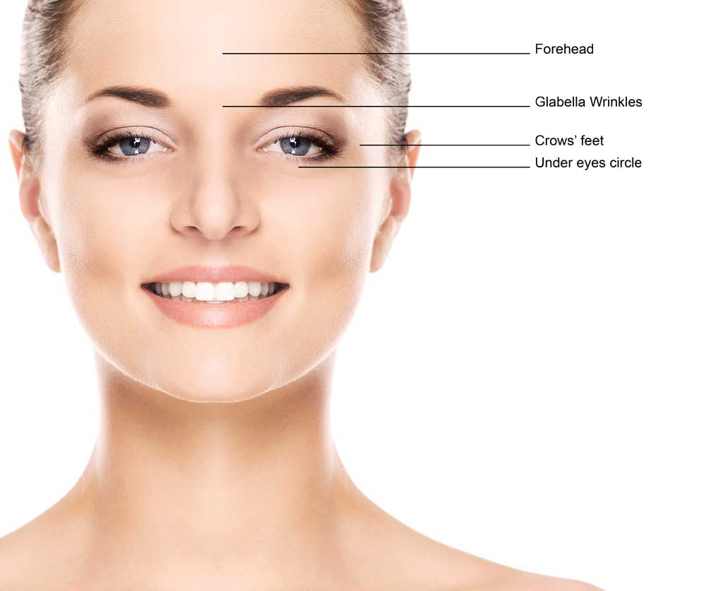 Hyamax® PLUS Fine 1 Hyamax Plus Fine Treatment Areas